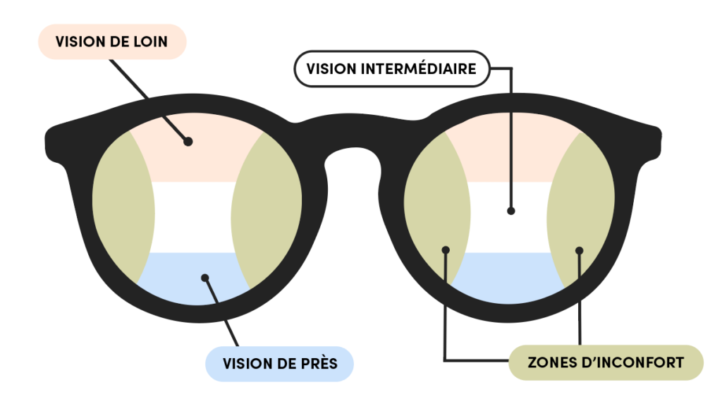 Schéma des différentes zones de vision de verres progressifs ou multifocaux.