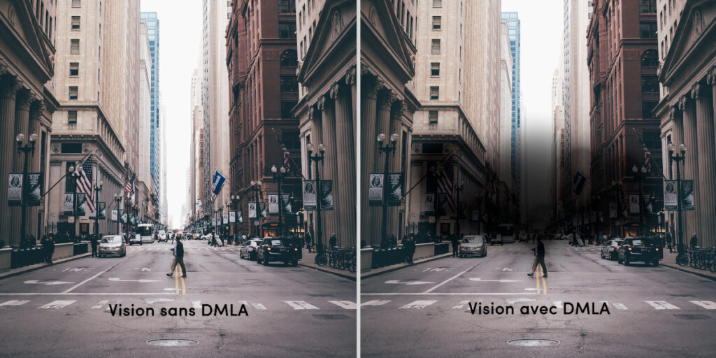 Comparatif de la vision sans DMLA (à gauche) et avec une DMLA (à droite). 
